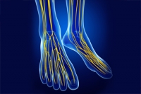 What Can I Do About Tarsal Tunnel Syndrome?