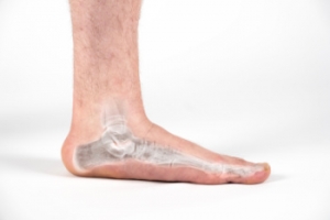 Facts About Flat Feet
