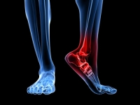 Heel Pain Location May Provide Clues to Its Cause