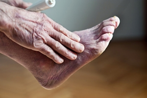 Causes and Possible Ways to Improve Poor Circulation