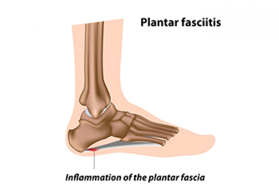 Heel Bursitis vs Achilles Tendinitis Exam - YouTube