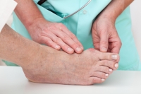 What Can Cause a Bunion?