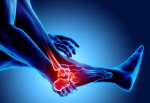 Rheumatoid Arthritis and the Feet