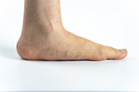 Flat Feet May Affect Adults